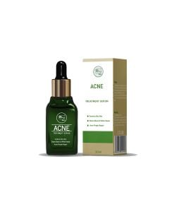 Acne Serum 30ml